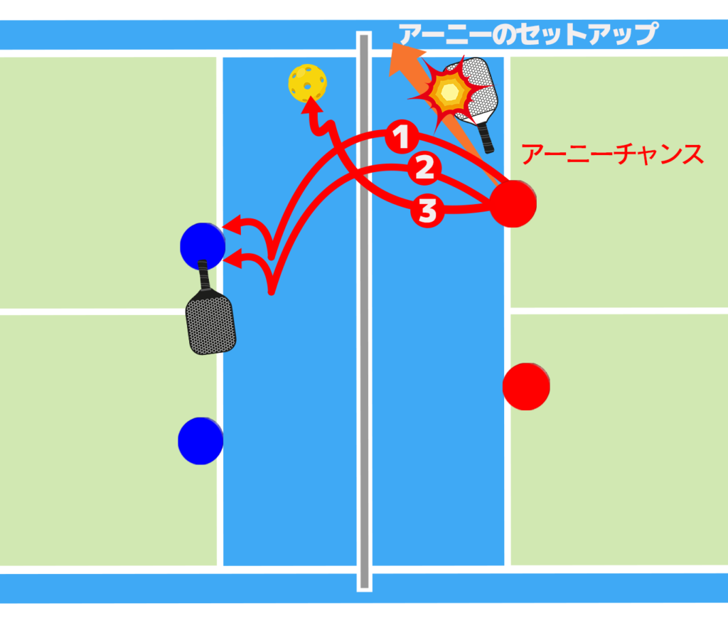 アーニーのセットアップを示した図③