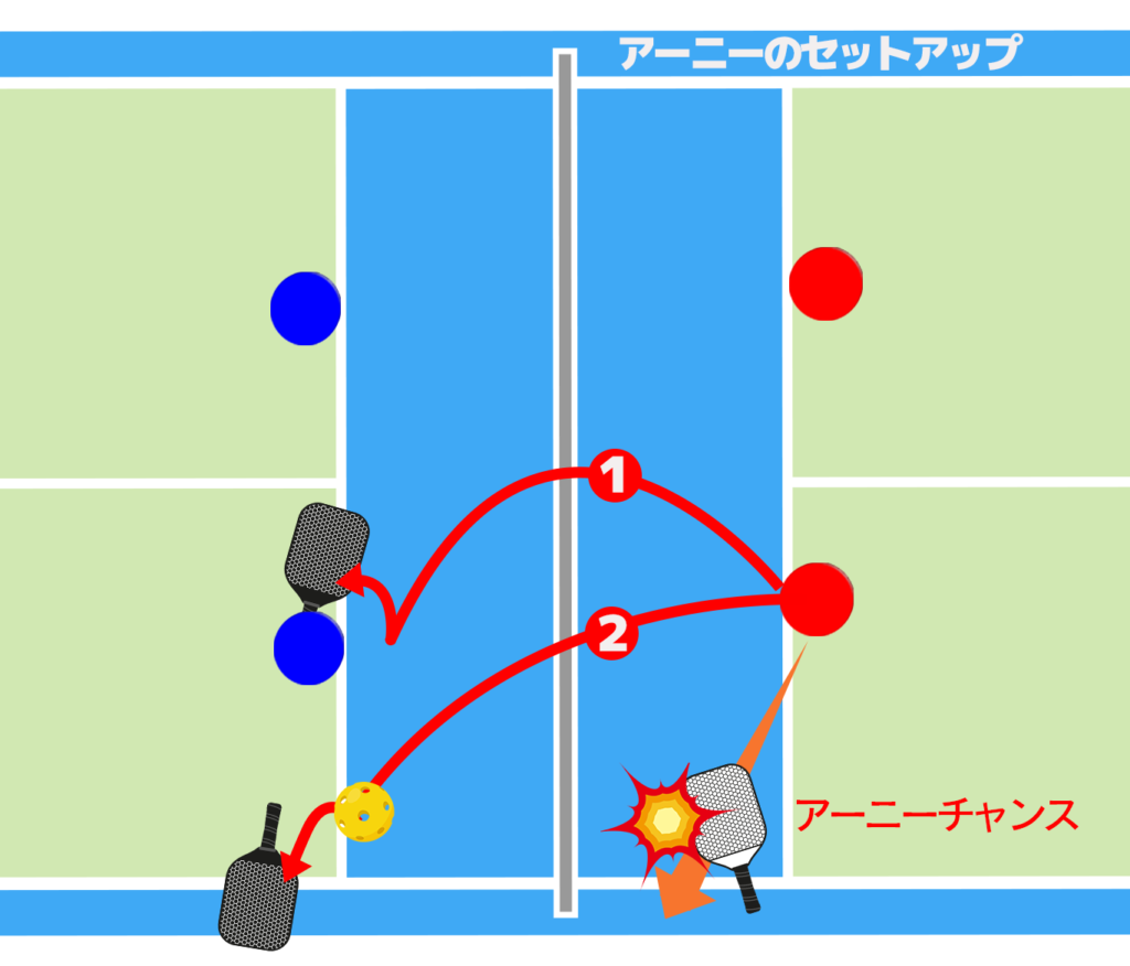 アーニーのセットアップを示した図①