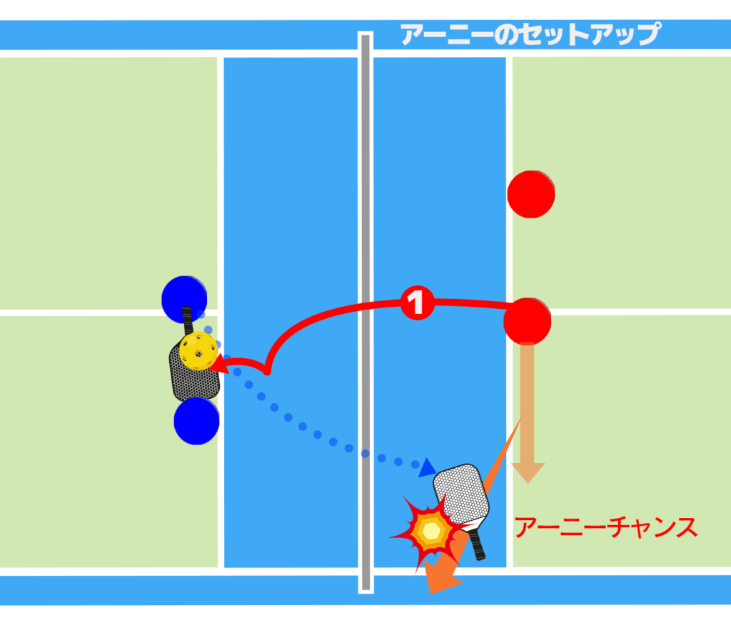 アーニーのセットアップを示した図③